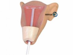 高级宫内避孕训练模型