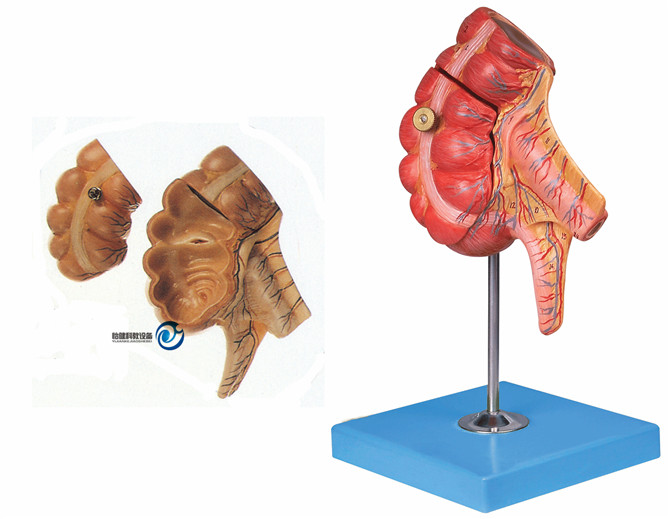 盲肠和阑尾模型