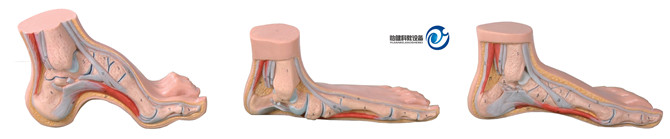 正常足、扁平足、弓形足模型